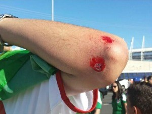 Um brasileiro foi ferido após agressão de mexicanos (Foto: Diana Vasconcelos/G1)