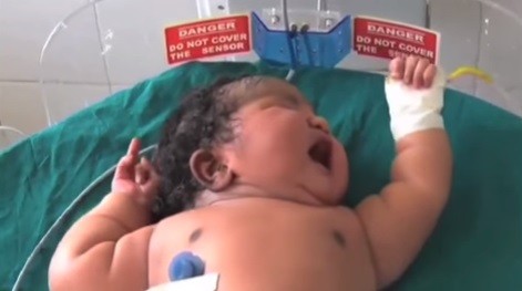 A menina tem o dobro do peso médio de um recém-nascido