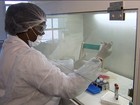 Polo sobre zika vírus vai investigar transmissão de mãe para bebê 