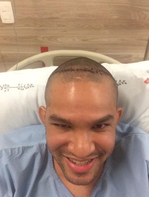 Vinicius Santos Teixeira exibe os pontos na cabeça após cirurgia (Foto: Reprodução/Facebook - 10822544_871428976224531_104368030_n