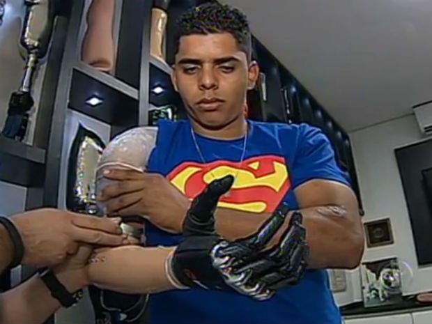David precisa se adaptar aos movimentos da prótese antes de passar a usá-la definitivamente (Foto: Reprodução/TV TEM)