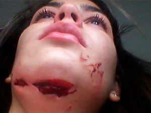 Dona de salão de beleza, Poliana de Lima levou tiro de raspão no pescoço (Foto: Poliana de Lima/Arquivo Pessoal)
