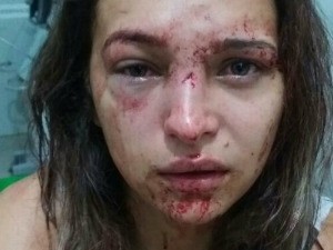 Pamela foi agredida porque estava na casa da ex-namorada de Deroci Barbosa  (Foto: Milliane Silva/Arquivo pessoal)