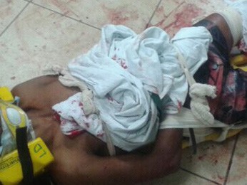 Preso que tentou fugir e foi baleado é colocado em maca do Samu, no Distrito Federal (Foto: Polícia Militar/Divulgação)