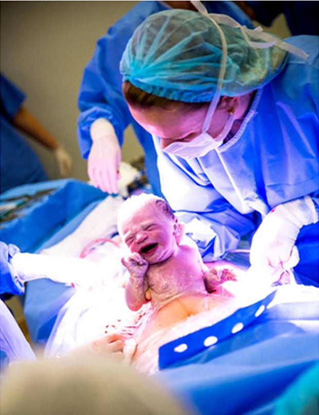 A primeira filha de Roberta, Maria Clara, que nasceu no ano passado: "Um dos remédios que tomei diminuiu o efeito do anticoncepcional e engravidei sem querer" (Foto: Arquivo pessoal)