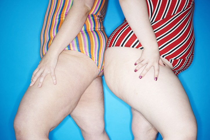 Dia do gordo: expressões gordofóbicas para tirar do vocabulário (Foto: Getty Images)