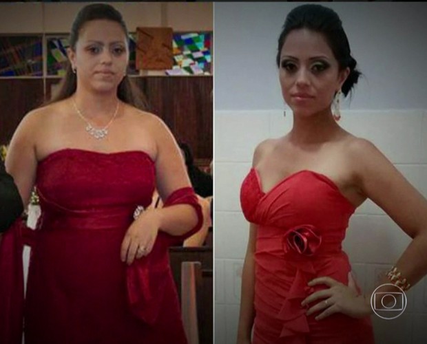 Veja quanta diferença no corpo de Giovana, depois de perder 40 kg (Foto: TV Globo)