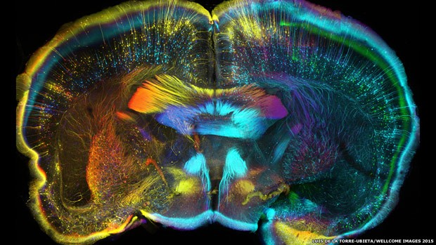 Foto feita com microscópio confocal mostra células nervosas em um corte vertical do cérebro de um rato adulto (Foto: Luis de La Torre-Ubieta/Wellcome Images 2015)