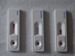 Teste rápido para detectar HIV, sífilis e hepatite C  (Foto: Tássio Andrade/G1)