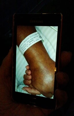 Foto da mão de Dominguinhos com a pulseira do Hospital Sírio Libanês, em São Paulo. ele segura a mão da mulher Guadalupe (Foto: Glauco Araújo/G1)