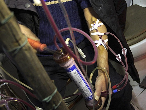 Chinês cria máquina caseira de hemodiálise (Foto: AP)