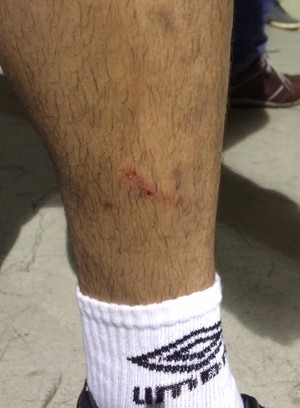 gilberto vasco canela penalti flu (Foto: Edgard Maciel de Sá)