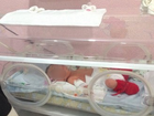 Bebê nasce dois meses após 
a bolsa da mãe estourar em SC