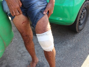 Idoto teve um dos joelhos fraturados (Foto: Ellyo Teixeira/ G1)