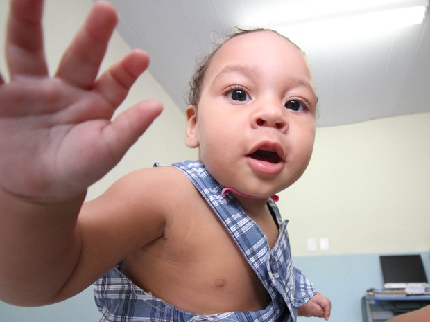 Guilherme Soares, de 11 meses, nasceu com microcefalia (Foto: Aldo Carneiro/Pernambuco Press)