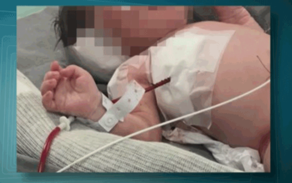 Bebê baleado ainda dentro da barriga da mãe, em Caxias (Foto: Reprodução TV Globo)