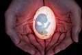 Embrião iluminado e água viva devorada são finalistas entre fotos de natureza (Robert Cabagnot)
