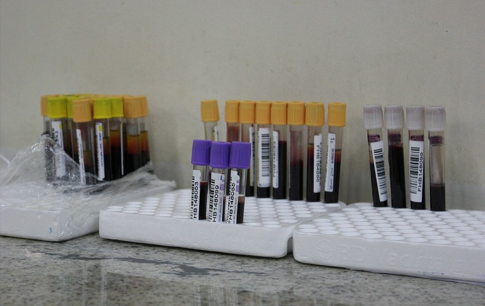 Amostras de sangue em laboratório do Amazonas (Foto: Girlene Medeiros/G1 AM)