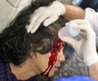 Mulher é 
ferida em protesto (Jackson Martins/VC no G1)