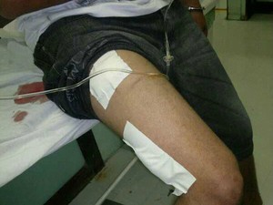 Assaltante atira contra a própria perna em Teresópolis (Foto: Divulgação/Polícia Militar de Teresópolis)