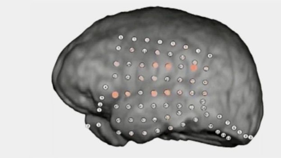 Pesquisadores observaram a atividade em áreas do cérebro (Foto: UC Berkeley)