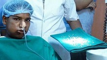 Adolescente indiano passa por longa cirurgia e tem 232 dentes extraídos (BBC)