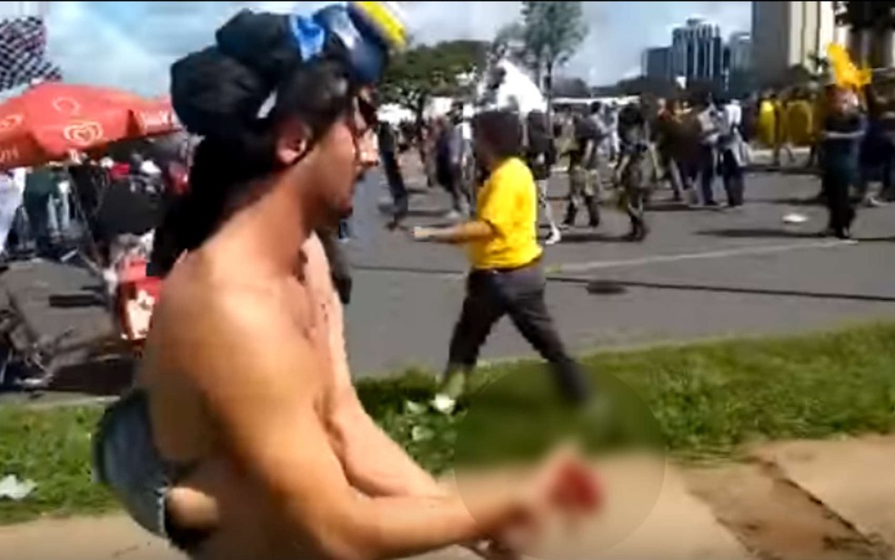Manifestante tem mão dilacerada em ato na Esplanada dos Ministérios, em Brasília (Foto: Reprodução)