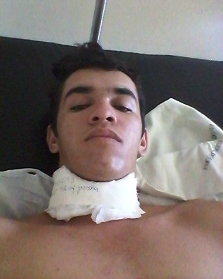 Jovem ferido por linha de cerol (Foto: Arquivo pessoal) Jovem ferido por linha de cerol (Foto: Arquivo pessoal)