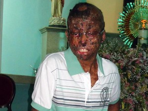 Garoto descobriu doença aos dois anos (Foto: Arquivo pessoal)