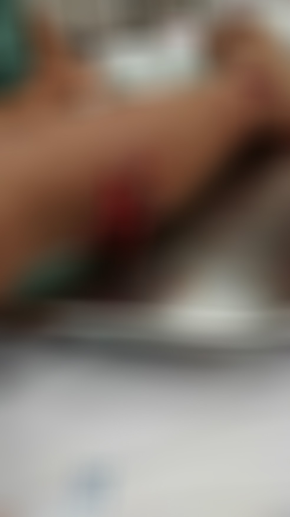 Ribeirão Preto, Gabriel vai passar por duas cirurgias curativas (Foto: Patrícia Schimidt / Arquivo Pessoal)