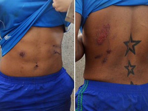 Verônica mostra ferimentos, que segundo ela, foram causados por agressões cometidas dentro da delegacia (Foto: Divulgação / Defensoria Pública)
