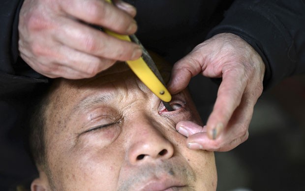 Barbeiro chinês usa navalha para limpar a parte interna da pálpebra de cliente (Foto: Reuters)