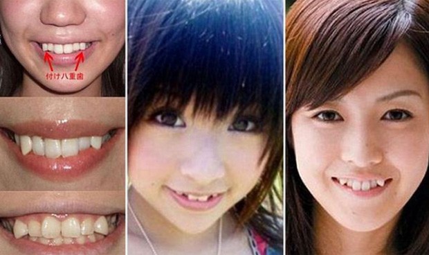 Jovens procuram dentistas para adicionarem prótetes que deixam o sorriso 'torto' (Foto: Reprodução/Facebook)