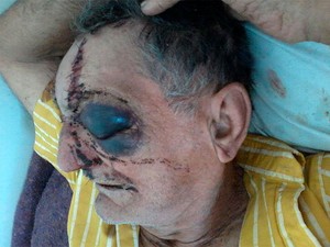 Idoso de 74 anos leva 40 pontos no rosto após espancamento na Bahia (Foto: Arquivo Pessoal)