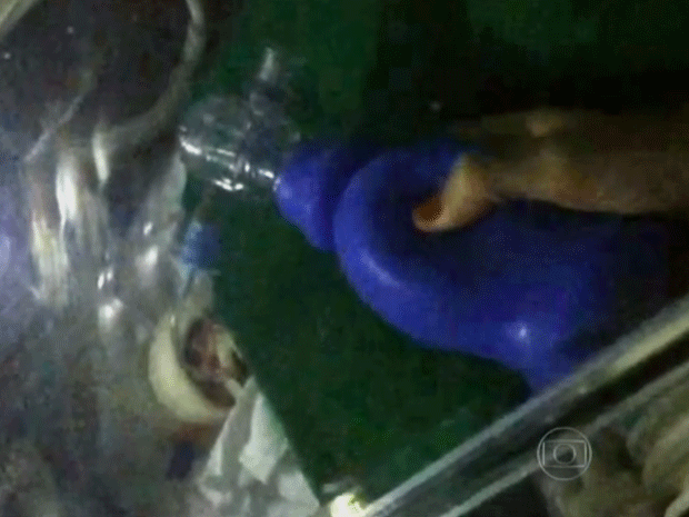 Médicos fazem ventilação mecânica em bebê durante apagão no Hospital Geral de Osasco (Foto: Reprodução/ TV Globo)