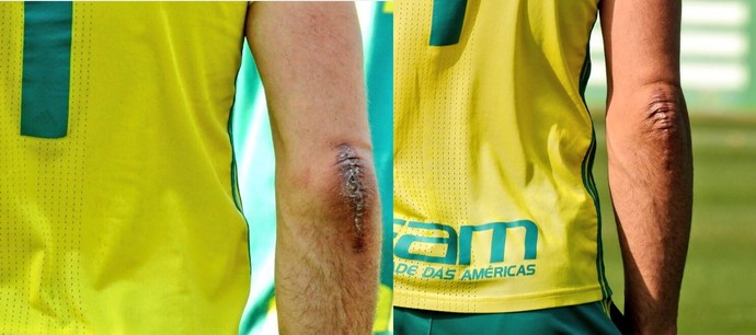 Fernando Prass pode ser liberado para treino de transição dentro de duas semanas