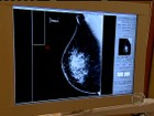 Exames das mamas são importantes para detectar precocemente o câncer