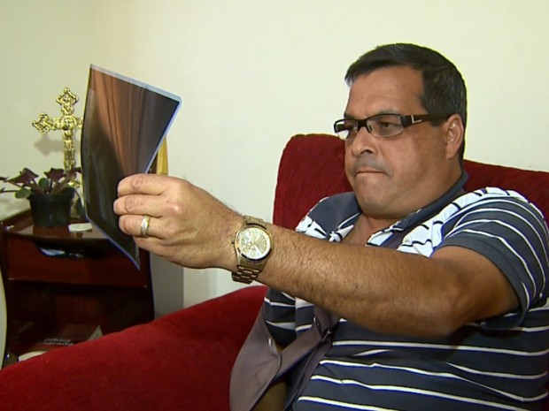 O pintor espera cirurgia no ombro há sete meses em Batatais, SP (Foto: Chico Escolano/EPTV) O pintor espera cirurgia no ombro há sete meses em Batatais, SP (Foto: Chico Escolano/EPTV)