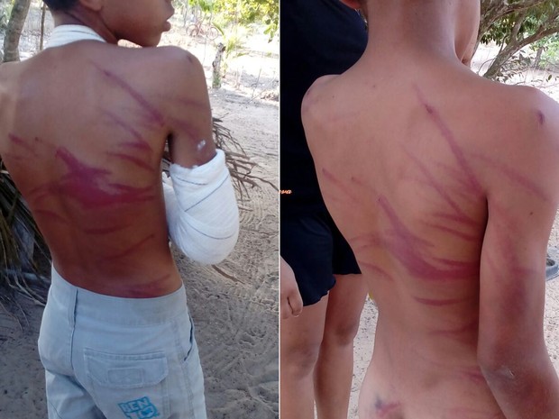 Com marcas da violência pelo corpo, criança foi levada para fazer exame de corpo de delito  (Foto: PM/Divulgação)