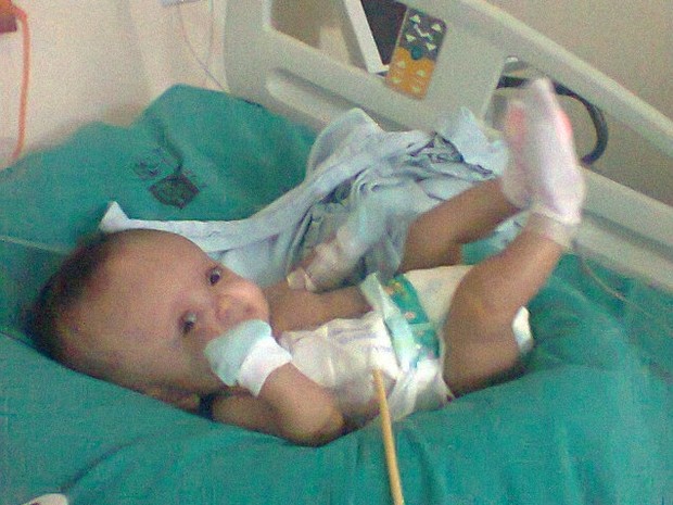 G1 - Bebê de três meses é internada com hidrocefalia em Cabo Frio, RJ ...