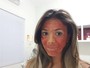 Fabiana Teixeira faz tratamento com sangue no rosto