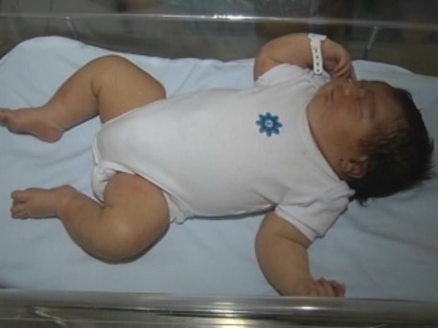 Segundo os médicos, o menino tem o tamanho de um bebê de 4 meses.  (Foto: reprodução/ TV Tem )
