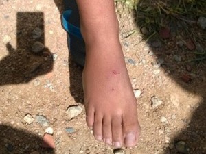 Agressora diz que vítima a mordeu no pé (Foto: Adriane Souza/G1)