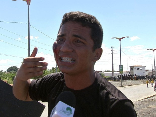 Manifestante é baleado com tiro de bala de borracha durante protesto (Foto: TV Verdes Mares/Reprodução)