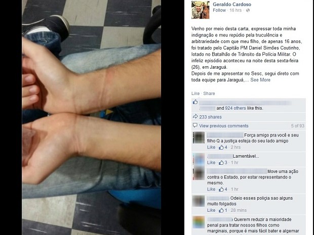 Cantor publicou uma foto nas redes sociais, mostrando o braço do filho marcado pelas algemas (Foto: Reprodução/Facebook)