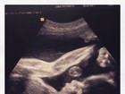 Luana Piovani mostra ultrassonografia de Liz: 'Fazendo alongamento'