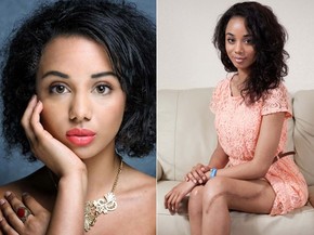 Jovem Supera Cancer Nos Ossos Com Proteses De Titanio E Vira Modelo Bem Estar G1