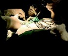 Médicos fazem cirurgias com material vencido (Reprodução/Fantástico)