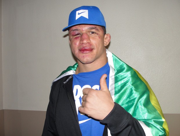 Junior Cigano na saída do hospital, em Las Vegas, após a 
derrota para Cain Velásquez (Foto: Marcelo Russio / SporTV.com)