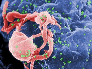 HIV (Foto: CDC/BBC)
